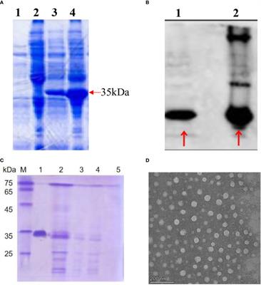 Frontiers | GE11-antigen-loaded Hepatitis B Virus Core Antigen Virus ...